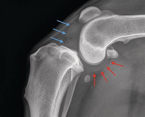 canine cruciate tear test|cranial cruciate ligament rupture diagnostic test.